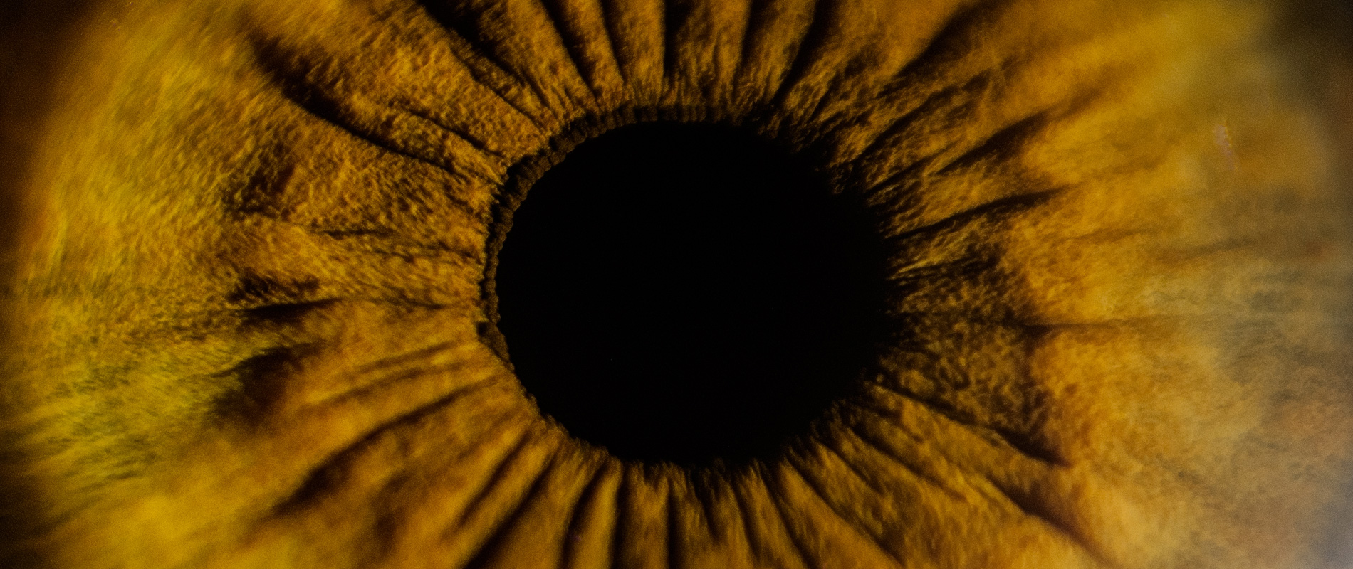 iris Box Hill Eye Surgeons